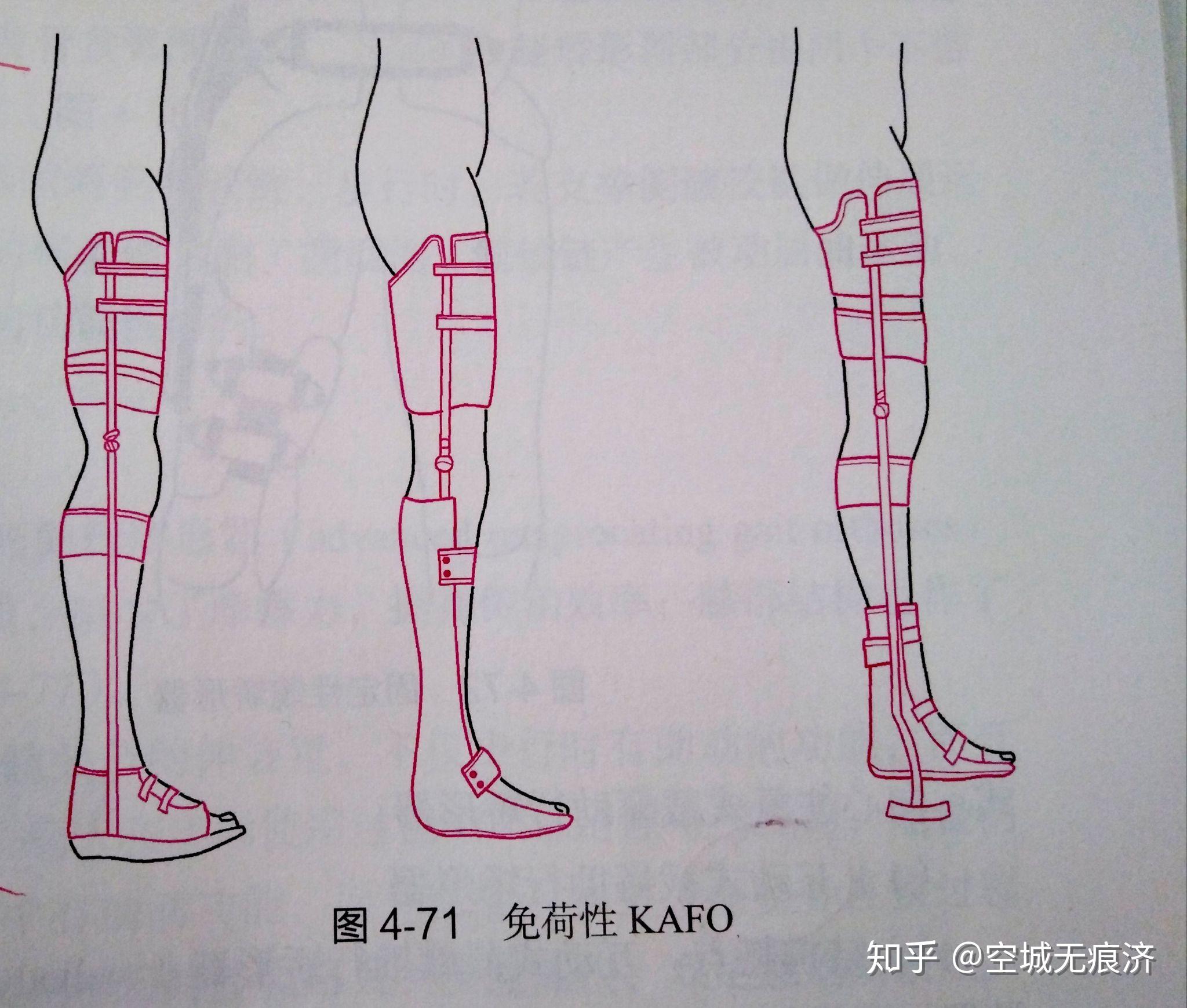 臨床康復(fù)工程學(xué) 假肢與矯形器的功能、設(shè)計(jì)與發(fā)展